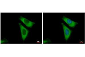 anti-Ribosomal Protein L29 (RPL29) antibody