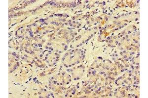 Immunohistochemistry of paraffin-embedded human pancreatic tissue using ABIN7158760 at dilution of 1:100 (LPCAT3 anticorps  (AA 306-363))