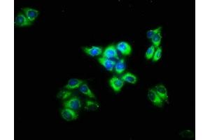 Immunofluorescence staining of Hela cells with ABIN7156945 at 1:133, counter-stained with DAPI. (IMPG2 anticorps  (AA 616-759))