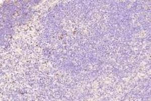 Immunohistochemistry analysis of paraffin-embedded mouse thymus using,TOX(ABIN7075899) at dilution of 1: 4000 (TOX anticorps)