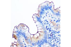 Immunohistochemistry of paraffin-embedded human appendix using CE Rabbit mAb (ABIN7266083) at dilution of 1:100 (40x lens). (CEACAM1 anticorps)