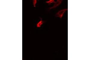 ABIN6275874 staining COLO205 by IF/ICC. (LY75/DEC-205 anticorps  (Internal Region))