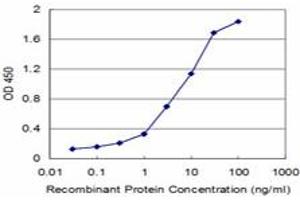 Detection limit for recombinant GST tagged UMPS is approximately 0. (UMPS anticorps  (AA 381-479))