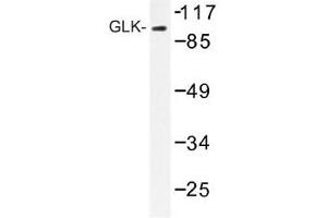 Image no. 1 for anti-Mitogen-Activated Protein Kinase Kinase Kinase Kinase 3 (MAP4K3) antibody (ABIN317719) (MAP4K3 anticorps)