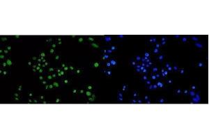 IF analysis of TPR using anti-TPR antibody (ABIN7603243). (TPR anticorps  (N-Term))