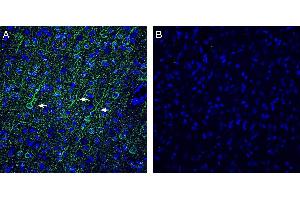 Expression of Vasopressin V1A Receptor in rat frontal cortex. (AVPR1A anticorps  (Intracellular))