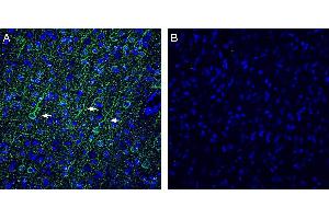 Expression of Vasopressin V1A Receptor in rat frontal cortex. (AVPR1A anticorps  (C-Term, Intracellular))
