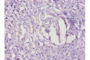 Immunohistochemistry of paraffin-embedded human kidney tissue using ABIN7173071 at dilution of 1:100 (TMEM14B anticorps  (AA 1-114))