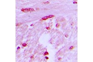 Immunohistochemical analysis of BTF3L4 staining in human brain formalin fixed paraffin embedded tissue section.