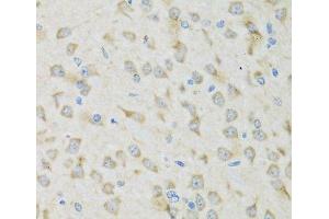 Immunohistochemistry of paraffin-embedded Mouse brain using CLCN7 Polyclonal Antibody at dilution of 1:100 (40x lens). (CLCN7 anticorps)