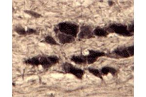 IHC on rat trigeminal nerve (free floating cryo section) using rabbit SORT1 polyclonal antibody  at a dilution of 1 : 1000. (Sortilin 1 anticorps)