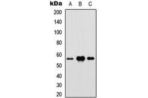 Western blot analysis of IRF5 expression in HEK293T (A), Raw264. (IRF5 anticorps  (Center))