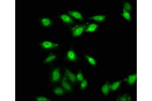 Immunofluorescence staining of Hela cells with ABIN7144009 at 1:66, counter-stained with DAPI. (AMMECR1 anticorps  (AA 146-248))