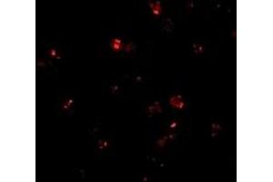 Immunofluorescence (IF) image for anti-Presenilin Enhancer 2 Homolog (PSENEN) (C-Term) antibody (ABIN1030574) (PEN2 anticorps  (C-Term))