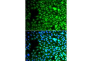 Immunofluorescence analysis of A549 cells using ZNF195 antibody. (ZNF195 anticorps  (AA 1-250))