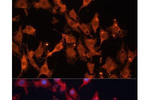 Immunofluorescence analysis of C6 cells using HSD17B1 Polyclonal Antibody at dilution of 1:100 (40x lens).