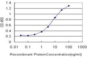 Detection limit for recombinant GST tagged GRK1 is approximately 0. (GRK1 anticorps  (AA 51-150))