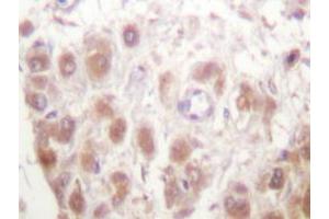 Immunohistochemistry analyzes of Rad52 antibody in paraffin-embedded human testis tissue. (RAD52 anticorps)