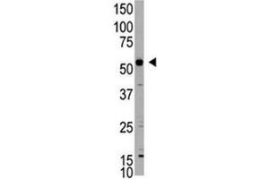Western blot testing of XIAP antibody and mouse liver lysate