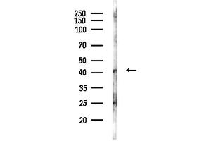 anti-Immediate Early Response 5-Like (IER5L) antibody