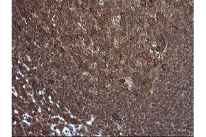 Image no. 3 for anti-Phosphoinositide-3-Kinase, Regulatory Subunit 5 (PIK3R5) antibody (ABIN1500211)