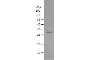 Western Blotting (WB) image for Chemokine (C-X-C Motif) Receptor 4 (CXCR4) (AA 1-80) protein (His-IF2DI Tag) (ABIN7122343) (CXCR4 Protein (AA 1-80) (His-IF2DI Tag))