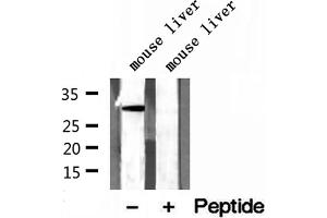 Western blot analysis of extracts of mouse liver tissue, using GNMT antibody. (GNMT anticorps  (Internal Region))