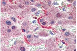 Liver, Human: Formalin-Fixed, Paraffin-Embedded (FFPE)