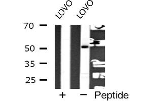 Western blot analysis of hnRNP K expression in LOVO cells (HNRNPK anticorps  (Internal Region))