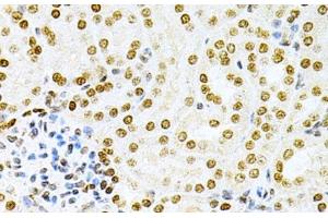 Immunohistochemistry of paraffin-embedded Mouse kidney using DKC1 Polyclonal Antibody at dilution of 1:200 (40x lens). (DKC1 anticorps)