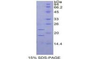 SDS-PAGE analysis of Rat PGF Protein.