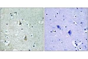 Immunohistochemistry analysis of paraffin-embedded human brain, using B-RAF (Phospho-Ser446) Antibody.