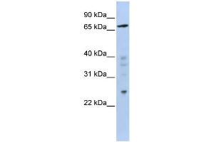 WB Suggested Anti-ZNF510 Antibody Titration:  0.