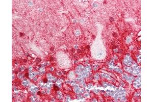 Human Brain, Cerebellum: Formalin-Fixed, Paraffin-Embedded (FFPE). (GLUL anticorps  (AA 301-350))