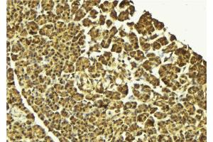 ABIN6269410 at 1/100 staining Mouse pancreas tissue by IHC-P. (IKBKG anticorps  (N-Term))