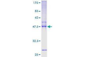 Image no. 1 for Twist Homolog 2 (TWIST2) (AA 1-160) protein (GST tag) (ABIN1324204)