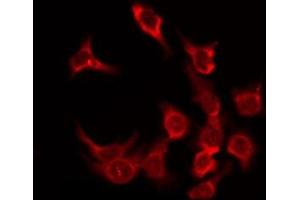 ABIN6276168 staining HeLa by IF/ICC. (OR5F1 anticorps  (C-Term))