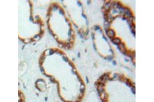 Used in DAB staining on fromalin fixed paraffin-embedded Kidney tissue