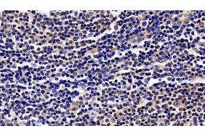 Detection of JAK3 in Human Lymph node Tissue using Polyclonal Antibody to Janus Kinase 3 (JAK3)
