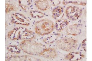 Formalin-fixed and paraffin embedded mouse kidney labeled with Rabbit Anti-CD13/APN/ANPEN Polyclonal Antibody, Unconjugated  at 1:200 followed by conjugation to the secondary antibody and DAB staining
