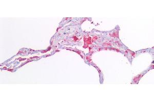 Detection of FTL in Human Lung Tissue using Polyclonal Antibody to Ferritin, Light Polypeptide (FTL)