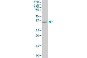 Western Blotting (WB) image for anti-Decapping Enzyme, Scavenger (DCPS) (AA 1-338) antibody (ABIN466201) (DCPS anticorps  (AA 1-338))