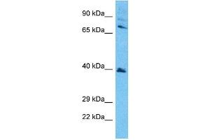 Host:  Rabbit  Target Name:  SETD7  Sample Type:  Jurkat Whole Cell lysates  Antibody Dilution:  1.