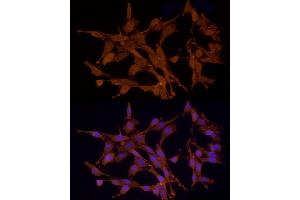 Immunofluorescence analysis of PC-12 cells using STK24 Rabbit pAb (ABIN6132364, ABIN6148602, ABIN6148603 and ABIN6214875) at dilution of 1:250 (40x lens).