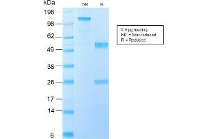 SDS-PAGE Analysis Purified IL-10 Recombinant Rabbit Monoclonal Antibody (IL10/2651R).
