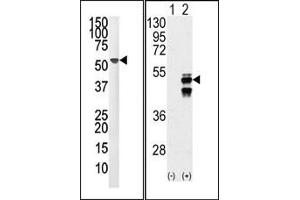 Image no. 1 for anti-Protein Phosphatase 1F (PP2C Domain Containing) (PPM1F) (N-Term) antibody (ABIN360800) (PPM1F anticorps  (N-Term))