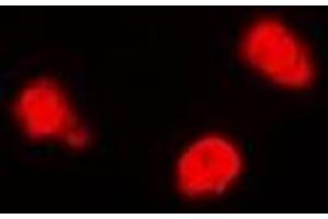 Immunofluorescent analysis of TIP60 staining in Jurkat cells.