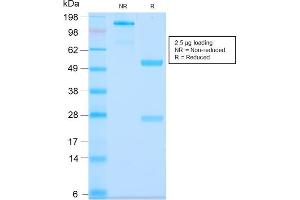 SDS-PAGE Analysis Purified MUC3 Rabbit Recombinant Monoclonal Antibody (MUC3/2992R). (Recombinant MUC3A anticorps)