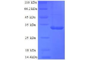 SDS-PAGE (SDS) image for Carbonic Anhydrase 12 (CA12) (AA 25-301), (Extracellular) protein (His tag) (ABIN5713304)
