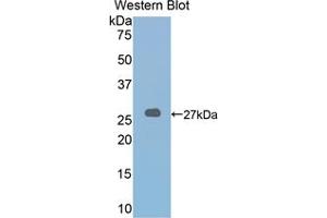 Western blot analysis of the recombinant protein. (LOXL2 anticorps  (AA 553-761))